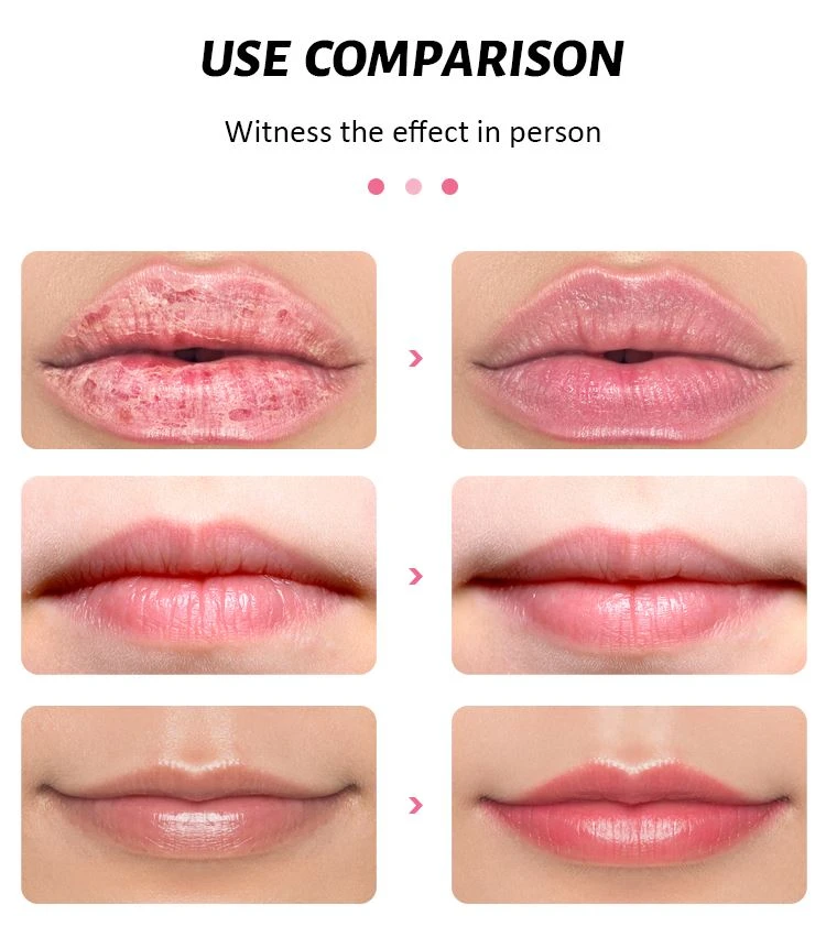 scrub for chapped lips